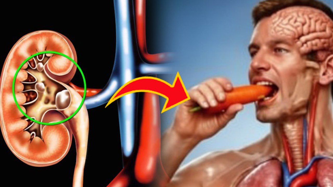 Pathri Me Gajar Kha Sakte Hai: पथरी में गाजर खा सकते है | Stone Me Carot Khane Se Kya Hota Hai ?