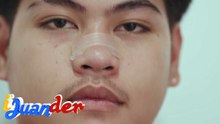 Goodbye hilik sa nasal strip! | I Juander