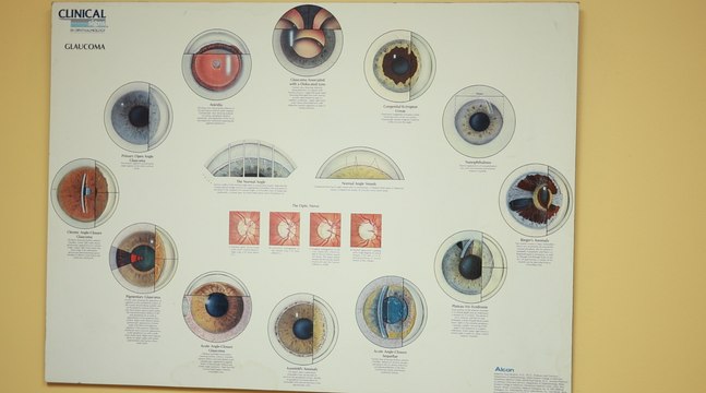 Los accidentes de tránsito y riñas lideran las causas de traumas oculares en República Dominicana