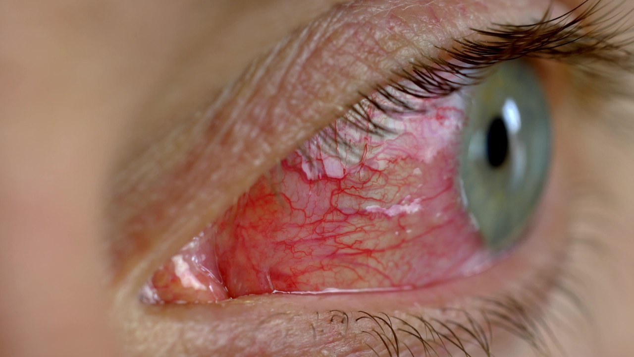 "Quelque chose qui est très impressionnant" : le docteur Jimmy Mohamed explique ce qui se cache vraiment sous les lunettes de soleil d'Emmanuel Macron