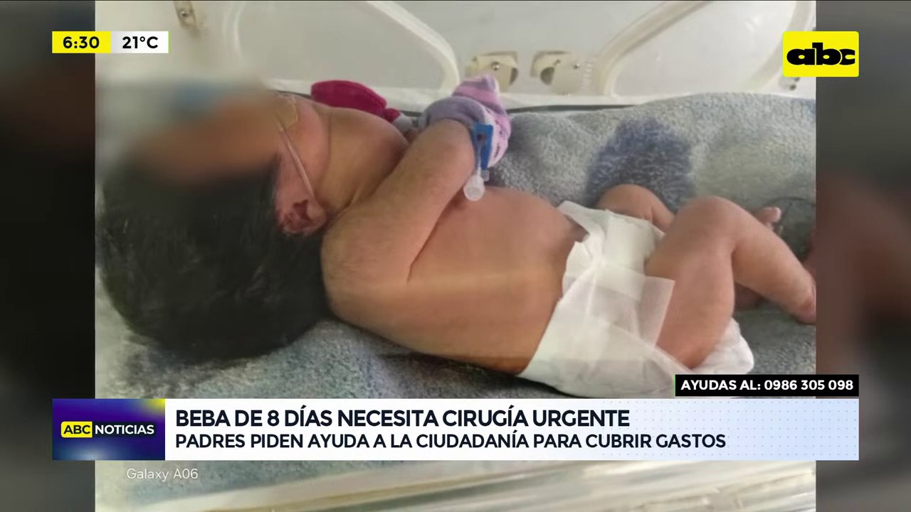 Bebé necesita cirugía y familiares piden ayuda para cubrir gastos