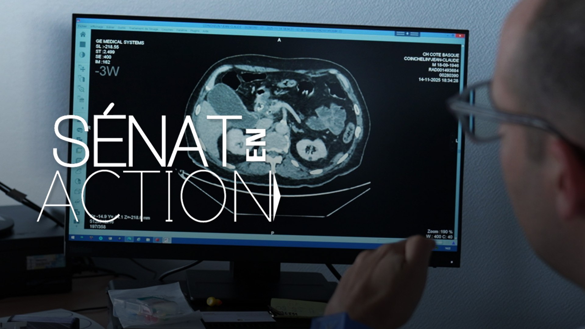 Cancers des jeunes, un tsunami à venir ?