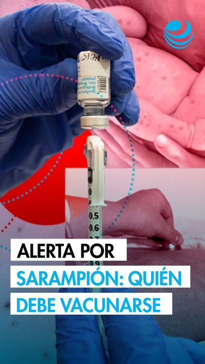 Brote de sarampión en México: ¿Quiénes deben vacunarse y cómo prevenir contagios?