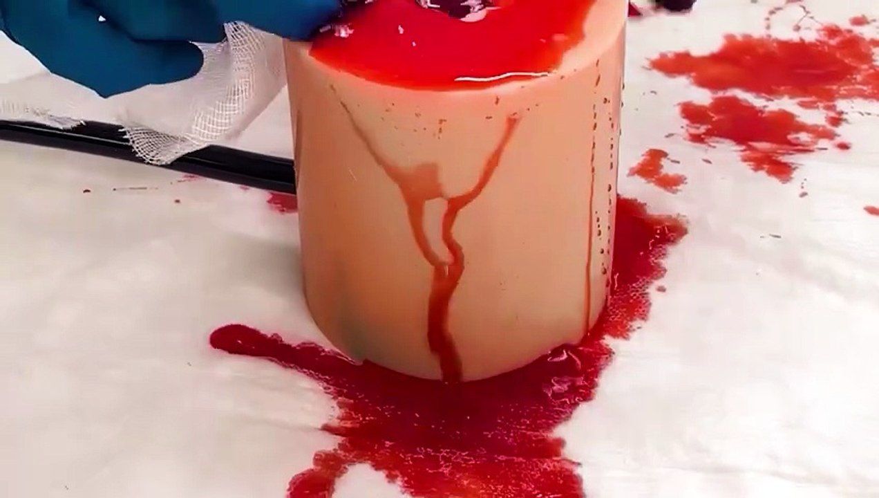 Comment les professionnels de santé pratiquent le pansement des plaies 🚑