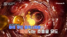 콜레스테롤 관리를 위한 필수템! '헤링오일' 섭취로 부기까지 사라졌다?!