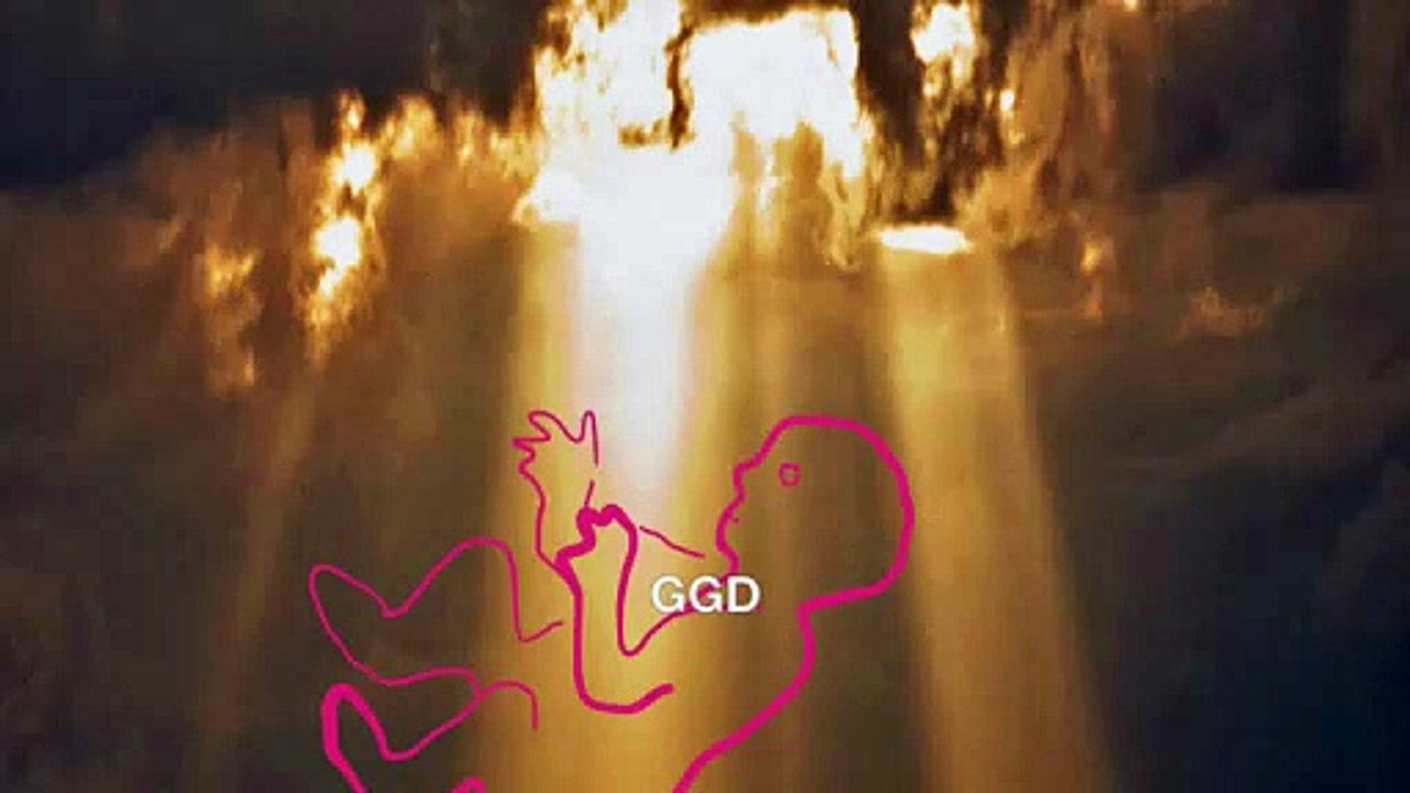 GGD