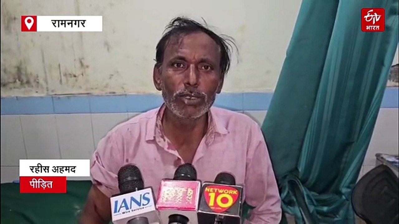 रामनगर में गुलदार का आतंक, खेत में काम कर रहे मजदूर पर किया हमला, दहशत में लोग