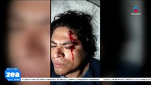Reporteros de Imagen Televisión Puebla fueron agredidos mientras realizaban cobertura