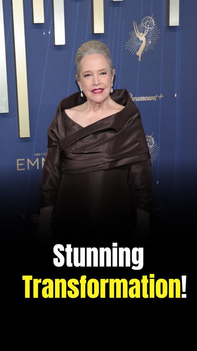 Kathy Bates Flaunts 100-Lb Weight Loss in White Dress, Credits Treadmill Walking for Health