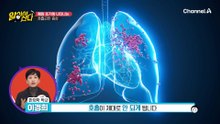 폐암을 의심할 수 있는 기침 증상! 폐의 상태에 따라 달라진다!