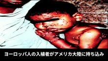 【豆知識】史上最悪パンデミック ワースト10　【Trivia News】The Worst Pandemics in History: Top 10
