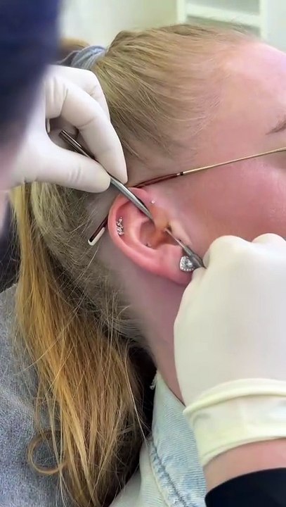 Thinking of a Daith Piercing? Watch This First. The Complete Guide #daithpiercing #cartilagepiercing