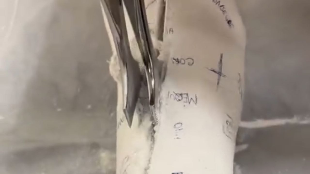 Plaster removal from the leg provides an oddly satisfying audio and visual experience