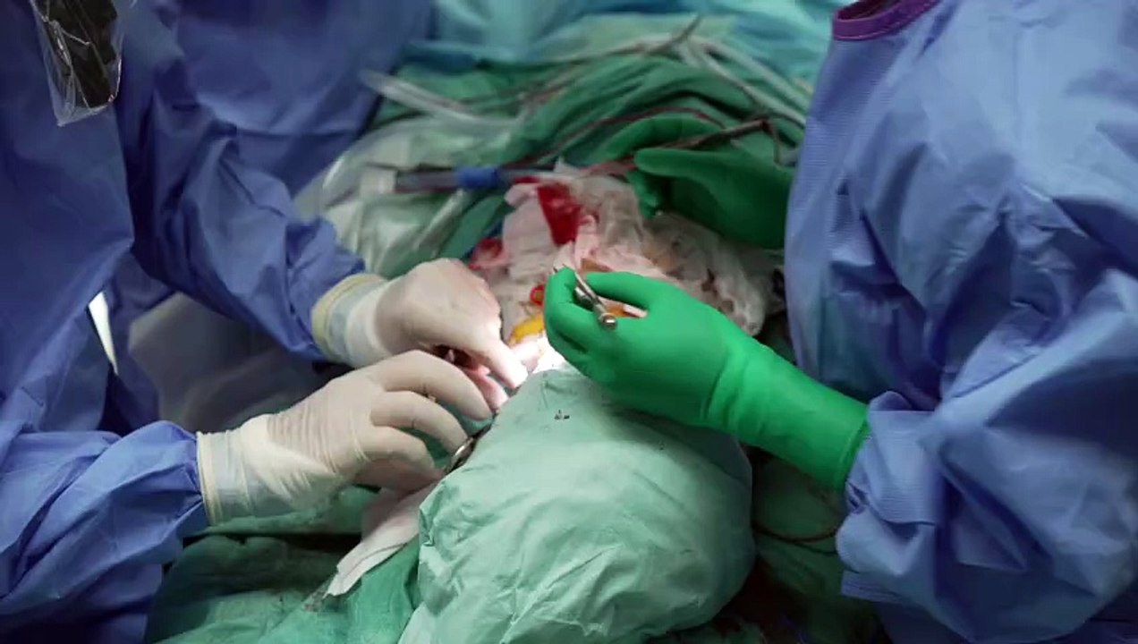 Vall d’Hebron realiza el primer trasplante de cara del mundo con una donante que recibió la eutanasia
