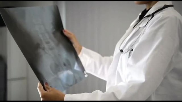 Tumore alla vescica in fase avanzata, nuova terapia anche in Italia