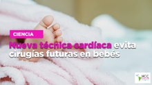 Nueva técnica cardíaca evita cirugías futuras en bebés