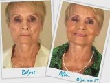 LifeCell Skin Anti Aging Skin Care Testimonials 1