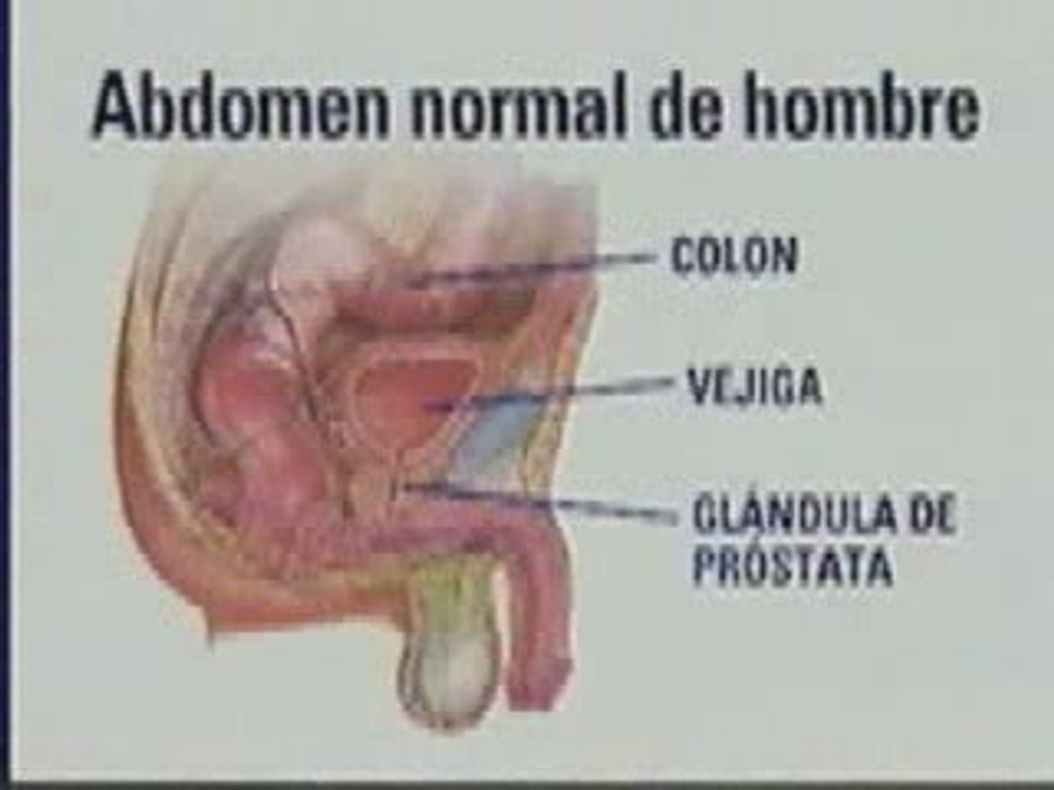 Como Limpiar El Colon