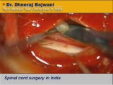 Spinal cord surgery in India to cure spinal cord injuries.