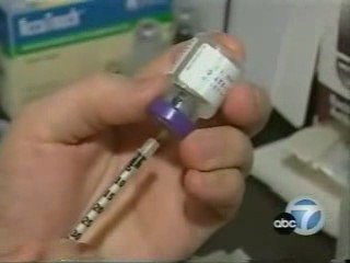 Botox for TMJ - Teeth Grinding