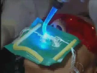 Peroxide Teeth Whitening News Clip