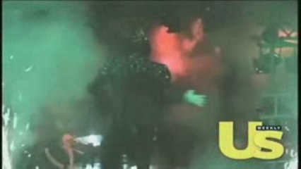 Michael Jackson inédit accident pepsi de 1984