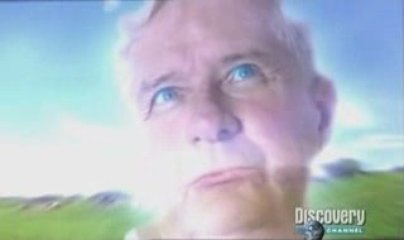 Hipnocirugia: El poder de la mente