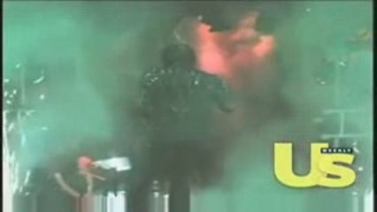 Accident Michael Jackson 1984