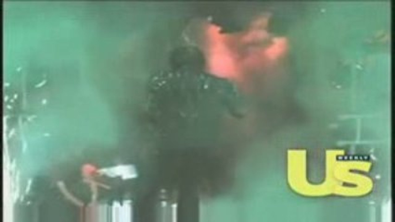 Accident Michael Jackson 1984