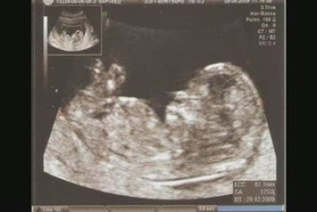 bébé bouge 16SG