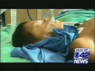 Robert Papong's Montgomery Area Plastic Surgery "Miracle"