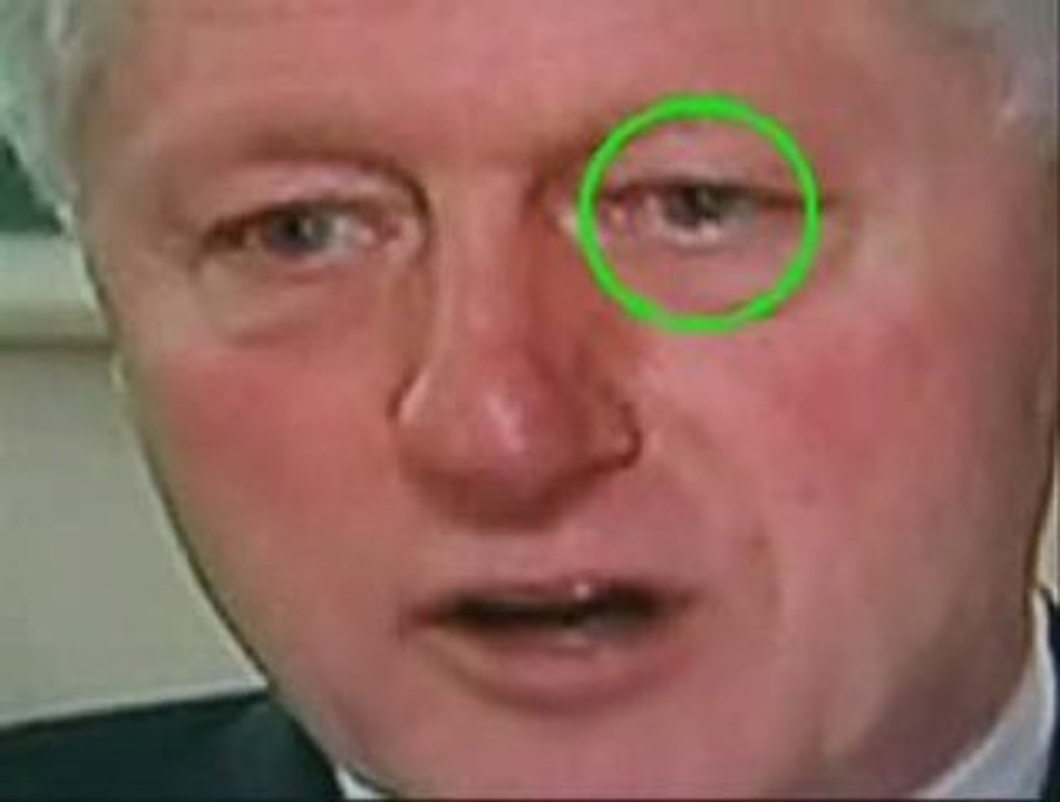 REPTILIAN ANOMALY FRENCH (lite version)