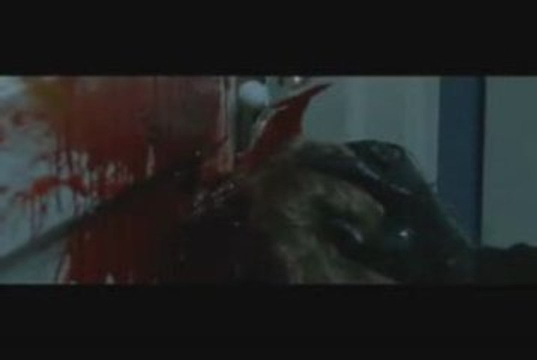 Clip 