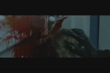 Clip 