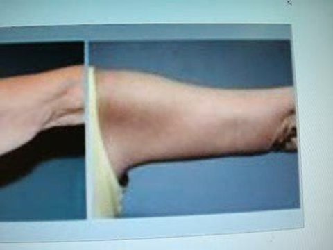 sculpting body image-qatar-dubai-iraq-نحت جسم-تجميل-دبي قطر-