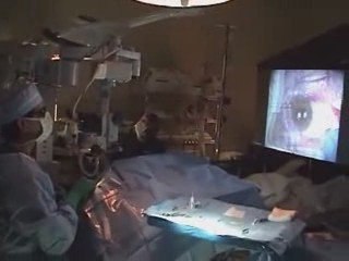Gulani Vision World's First 3D Imax screen Amniotic surgery