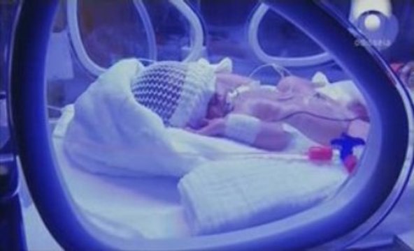 Bebes prematuros