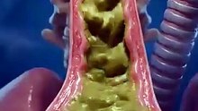 What Happens If You Eat Avocado Daily healthfacts nutrition shorts