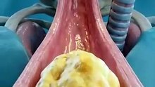 Eat Omelette for Breakfast Heres What It Does to Your Body protein healthtips nutrition