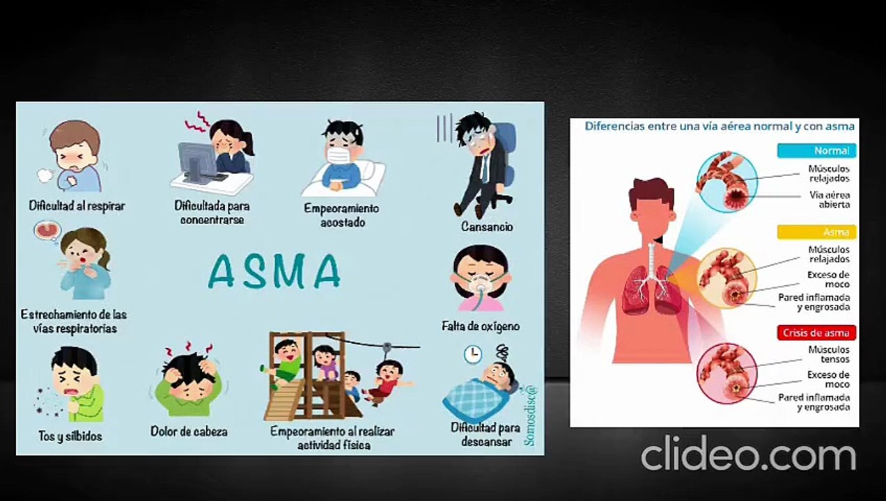 ASMA