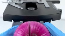 Onion under microscope