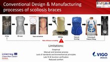 Rational Design For 3D Printable Spinal Orthoses