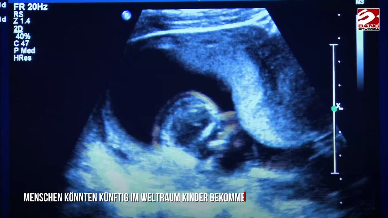 Menschen könnten bald Babys im Weltraum bekommen