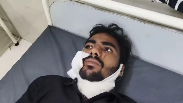 प्रेम प्रसंग में मौसी के लड़के पर जानलेवा हमला, मौसेरे भाईयों ने गले व गाल पर मारे चाकू