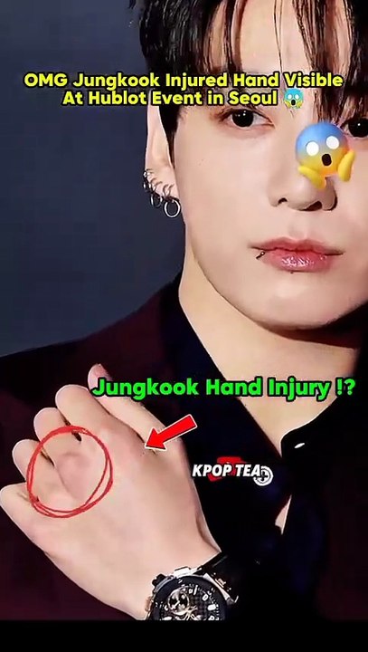 Jungkook Hand Injury During Event  #bts #btsarmy #btsshorts #jungkook #jeonjungkook #taehyung#btsv