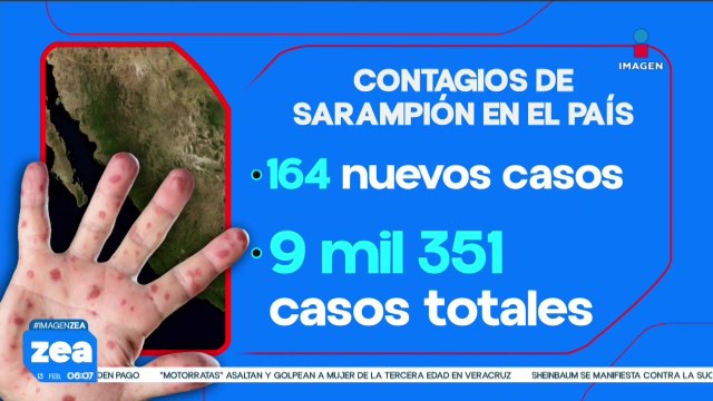 Contagios de sarampión siguen en aumento, suman nueve mil 351 casos