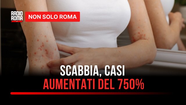 Allarme scabbia, nel Lazio casi in aumento del 750%: cosa dobbiamo sapere