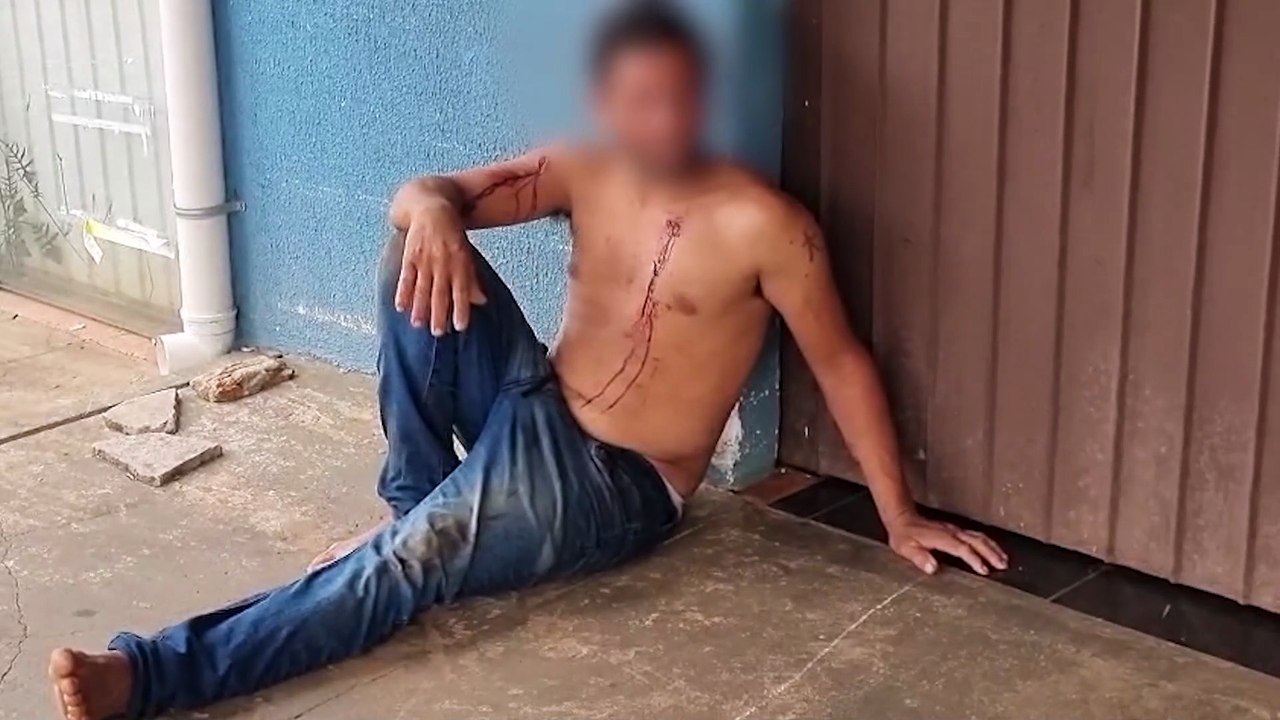 Homem é perfurado com garrafa de vidro pela ex-companheira no Bairro Universitário, em Cascavel