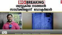 മാല വിഴുങ്ങി മോഷ്ടാവ്; നാല് ദിവസമായി കാത്തിരിപ്പ് തുടർന്ന് പൊലീസ്