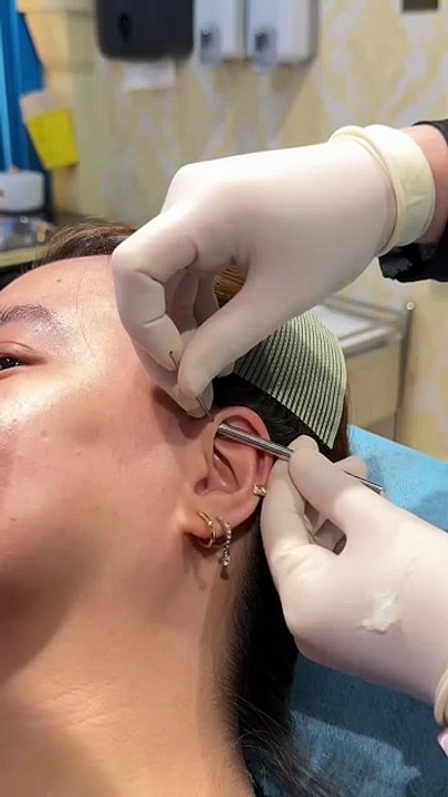 Architectural Edge: The Forward Helix Piercing #forward #helixpiercing #daithpiercing #earpiercing